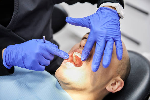 Best Emergency Dental Extractions in Cumming, GA